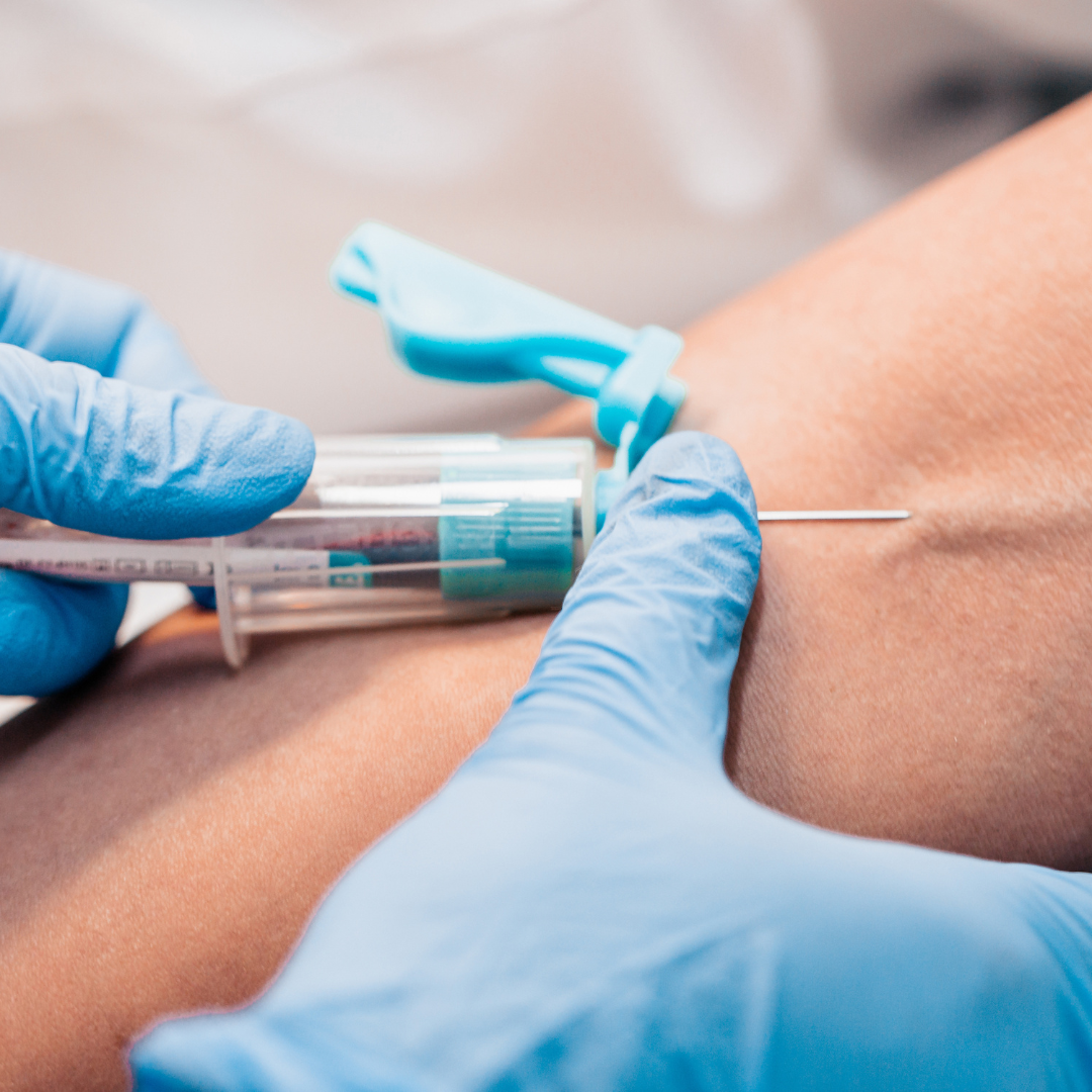 Phlebotomy - Castle Avenue, Winchester - Thursday 12th June 2025 - 9.30am